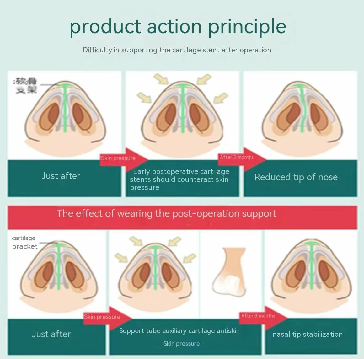 Nose Bridge Straightener Corrector Nose Shaper Clip Up Lifting Soft Safety Silicone Rhinoplasty For Wide Crooked Nose Nasal Cli