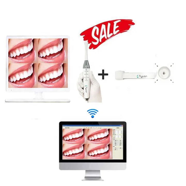 Dental Intraoral Camera with 19inch LED Monitor