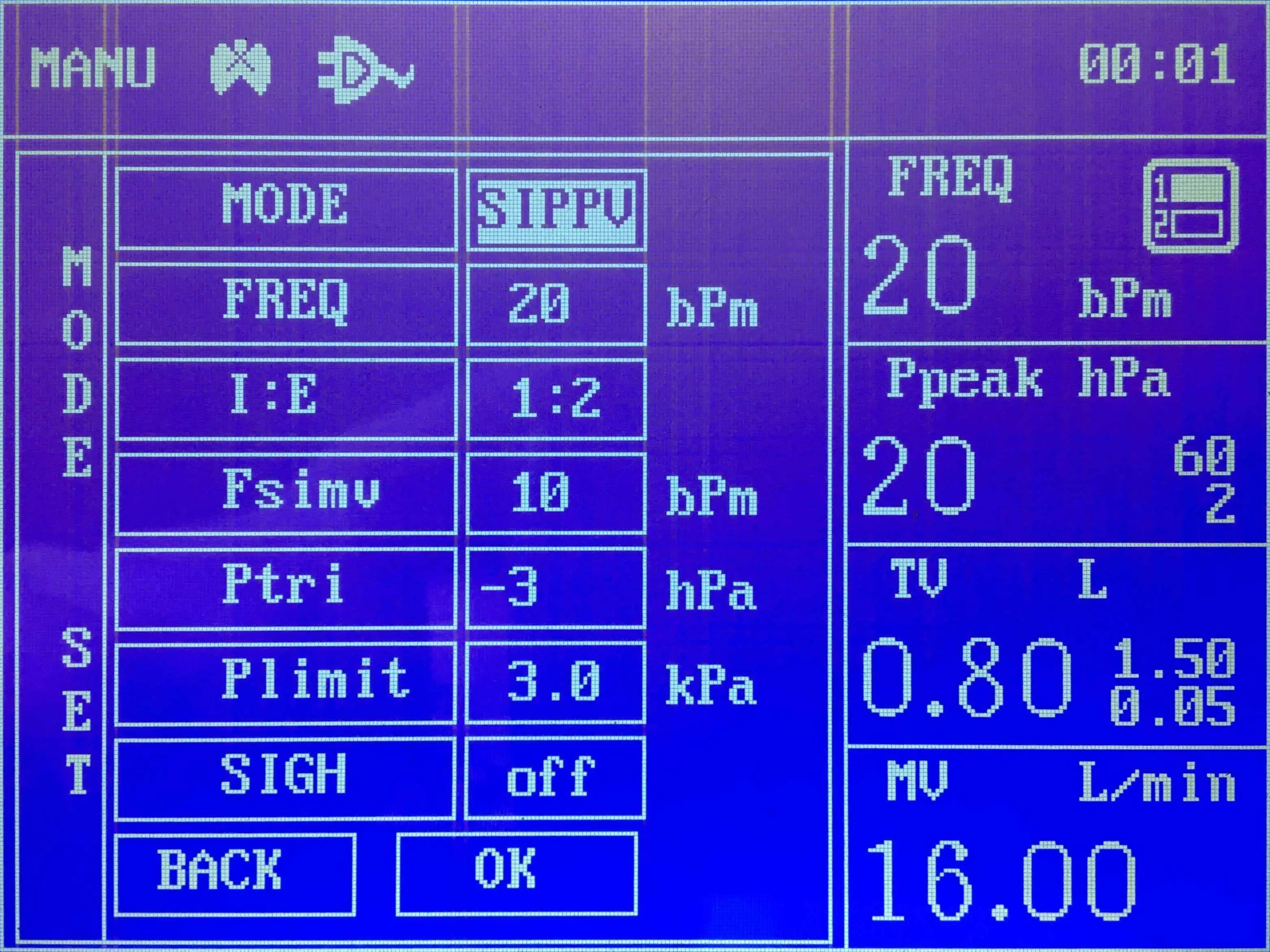 Top quality Anesthesia machine manufacturer JINLING-01B with ISO