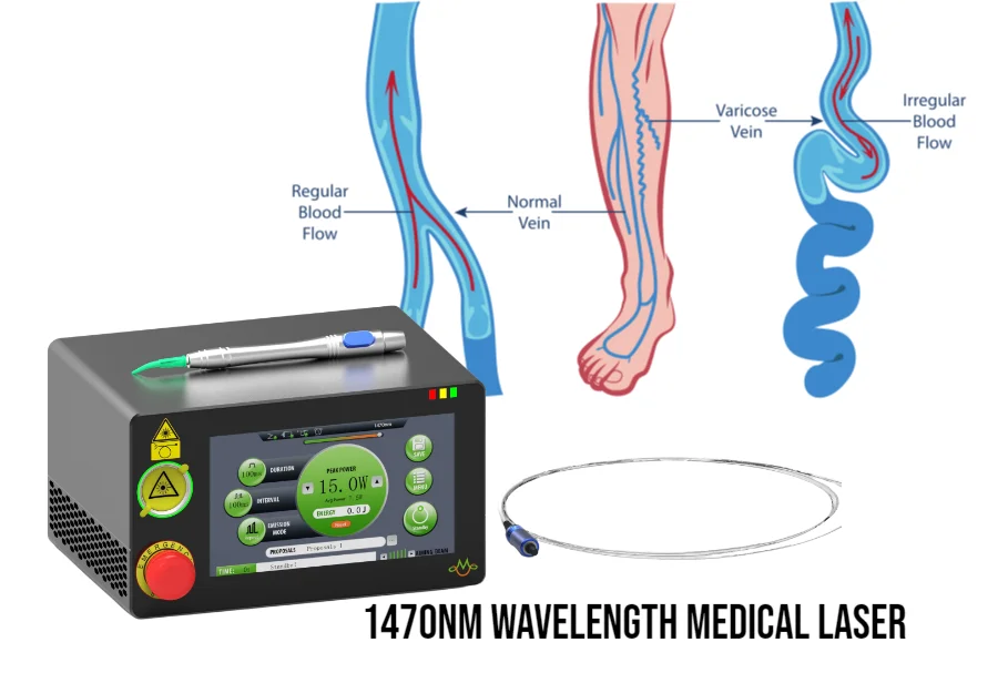 Varicose Veins - 1470nm laser Endovenous  medical laser surgical equipment