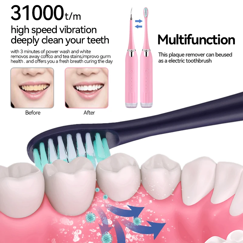 Ультразвуковой USB-очиститель, Электрический двухцелевой отбеливающий стоматологический скалер, стоматологический скалер