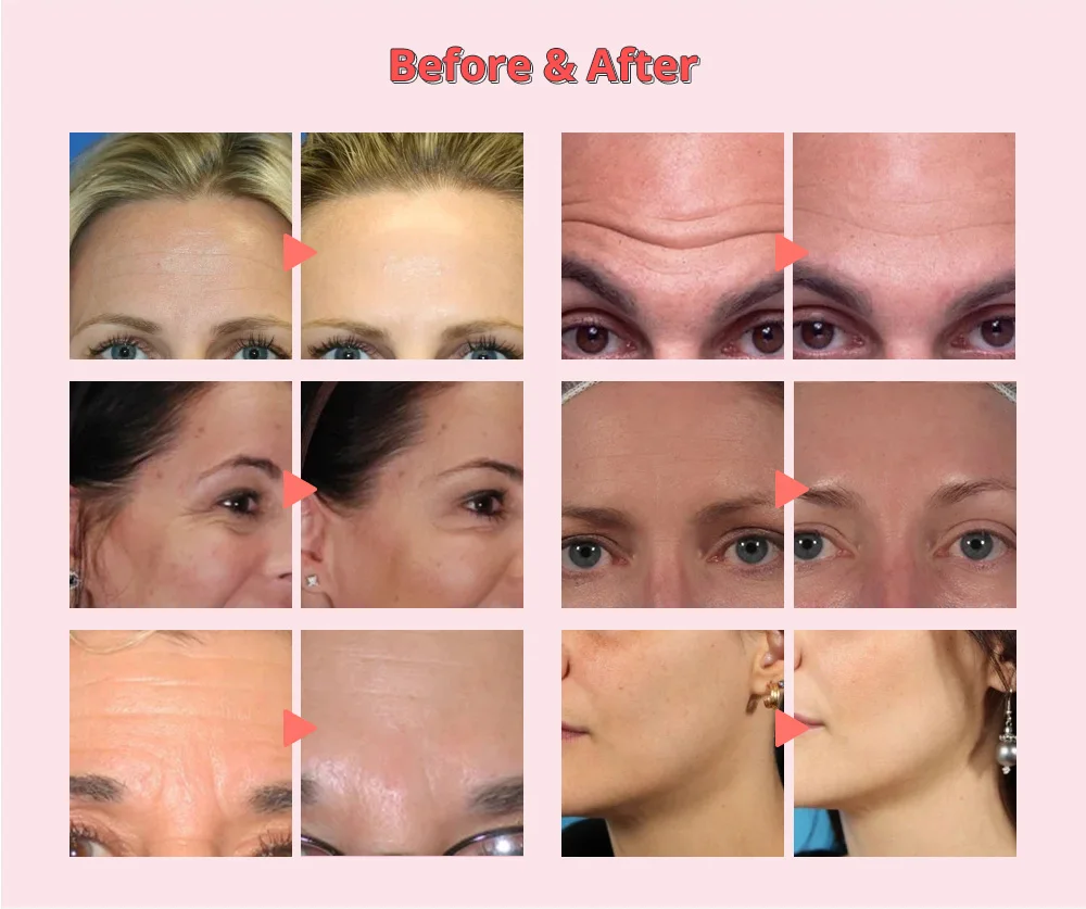 12 in 1 Multifunctional 3Mhz Ultrasonic Scrubber dermabrasion peeling positive negative ion micro current magic gloves machine