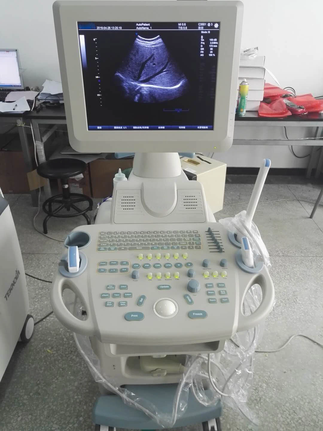 Medsinglong Trolley Color Doppler System Medical Ultrasound machine Color Doppler Diagnostic Trolley Ultrasound Machine