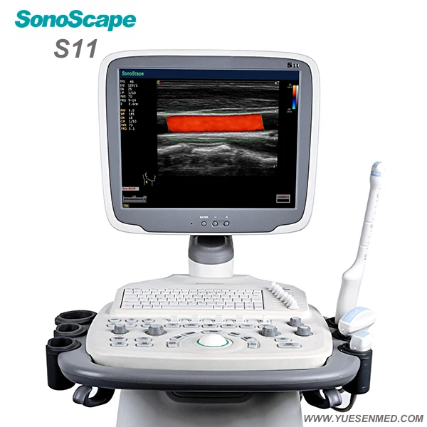 Хорошая цена медицинская тележка типа ультразвук S11 Sonocape 3D/4D Цветной Допплер ультразвуковой