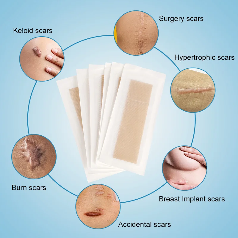 Medical-grade silicone dressing scar removal Patch Self-adhesive scar repair tape patch
