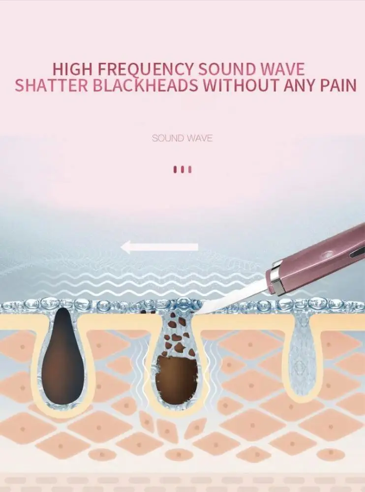 Портативный ультразвуковой скребок для удаления черных точек на носу