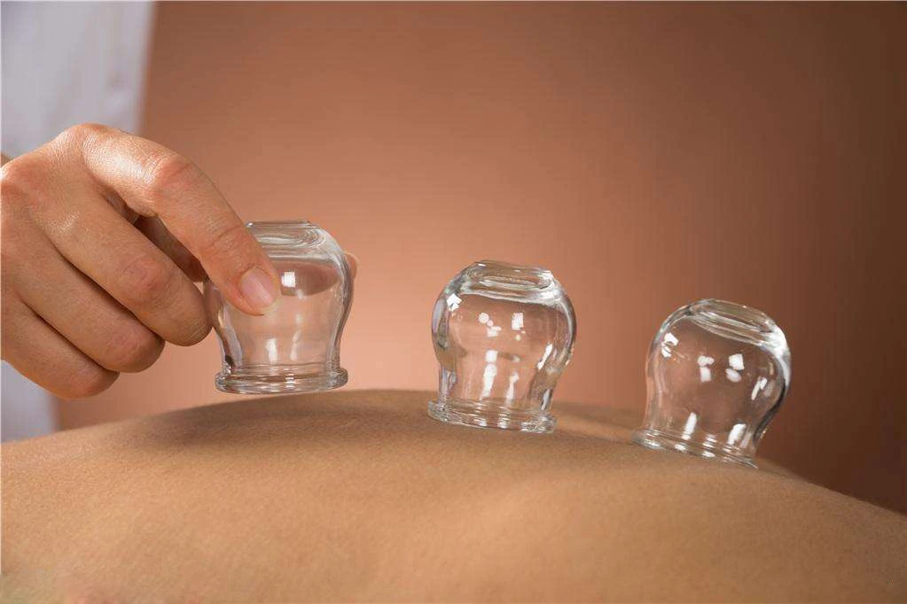 medical cupping glass vacuum cupping therapy