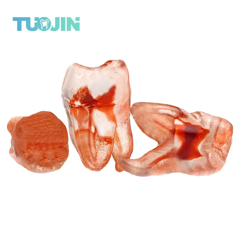 Dental Upper Molar Teeth Pulp Models Red Root Canal Bolcks Endo Files For Dentist Study 3D Simulation Tooth Dentistry Instrument