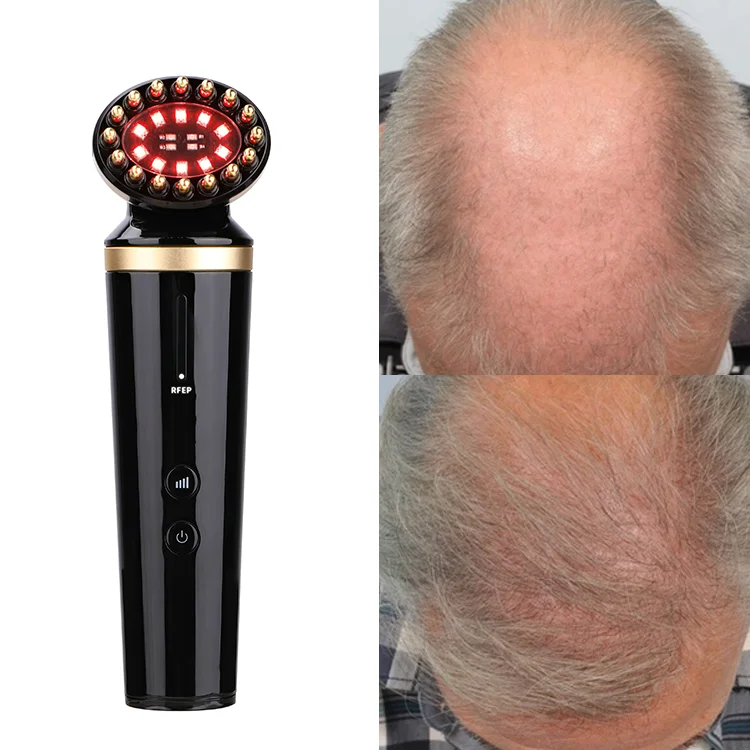 Free Sample Quick Custom Label Laser Ionic Styling Brush Infrared Health Therapy Hair Growth Machine Comb