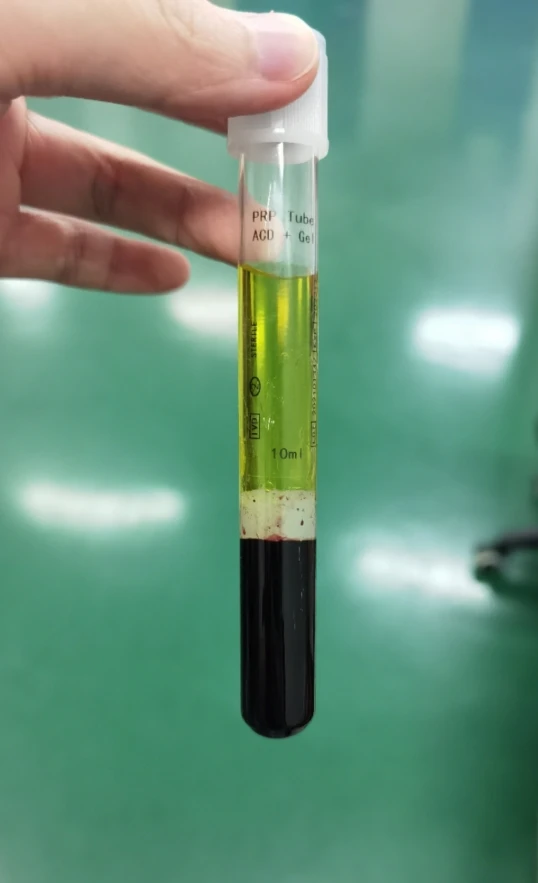 hair grow 7ml popular 8ml  prp tubes with acd separating gel prp tube manufacturer best PRP tube for hair