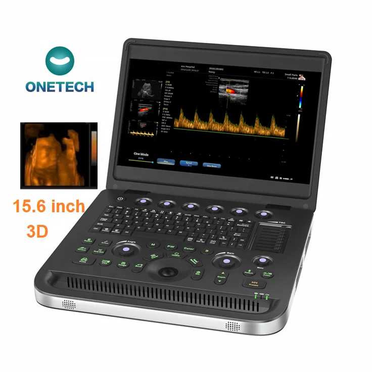 C10 benchtop 3D doppler Ultrasound Device Laptop Ultrasound Machine for Pregnancy portable color doppler echo machine