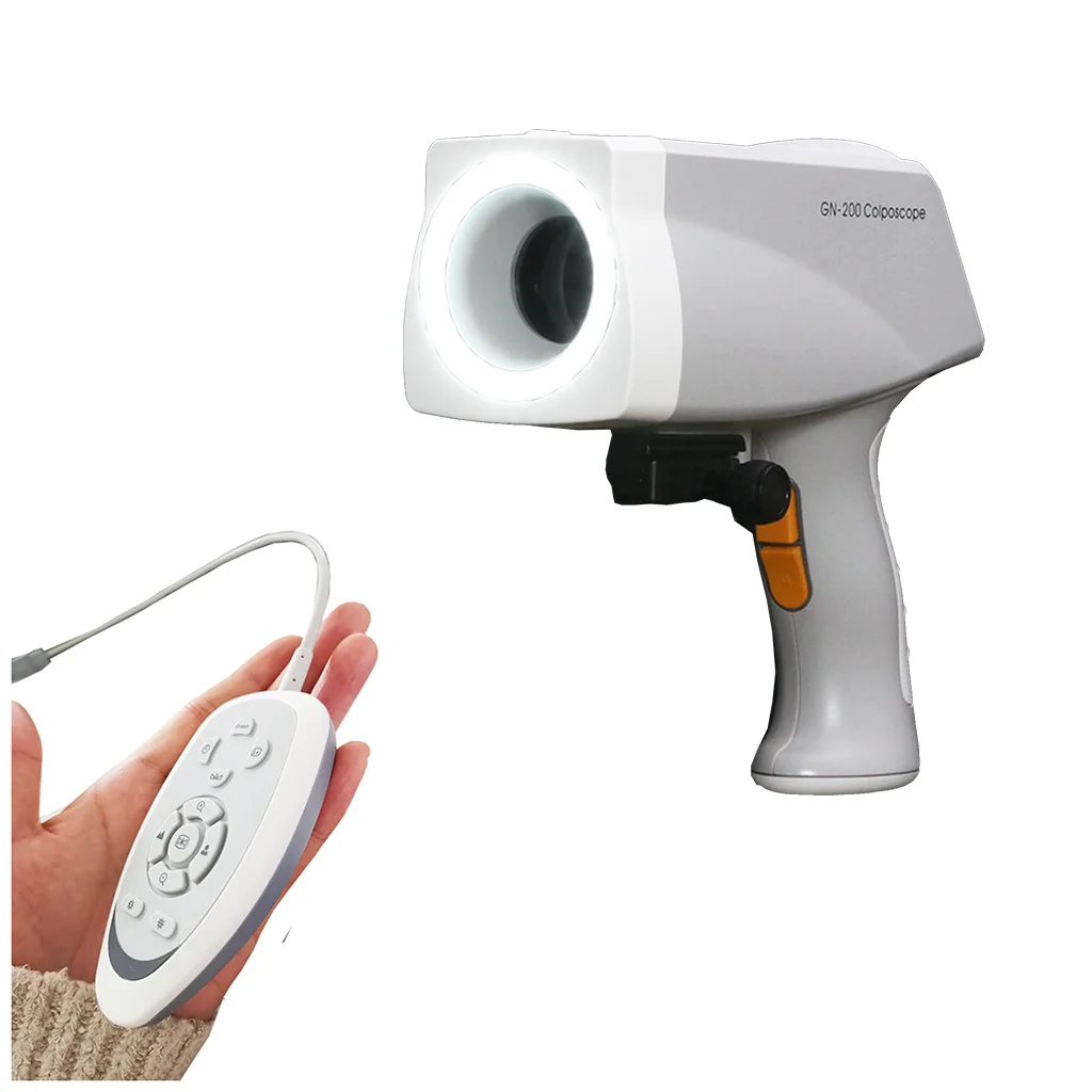 Colposcope Video KN-2200 Digital Colposcope Vaginal Camera for Gynecology