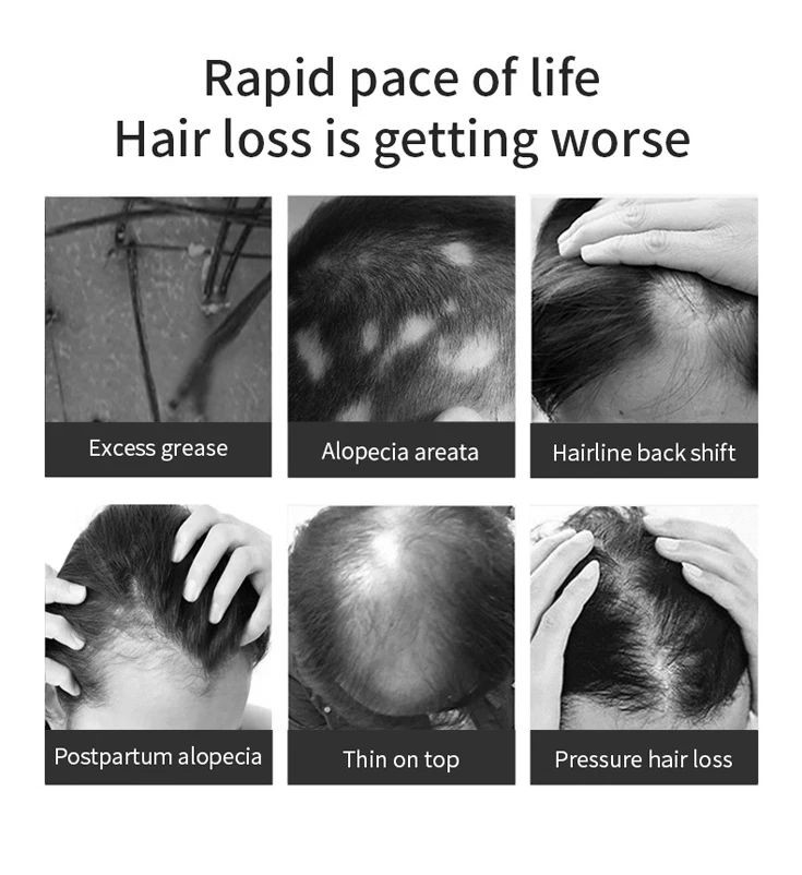 Best Hair Growth Serum for Women, Custom Natural Organic Hair Growth Serum