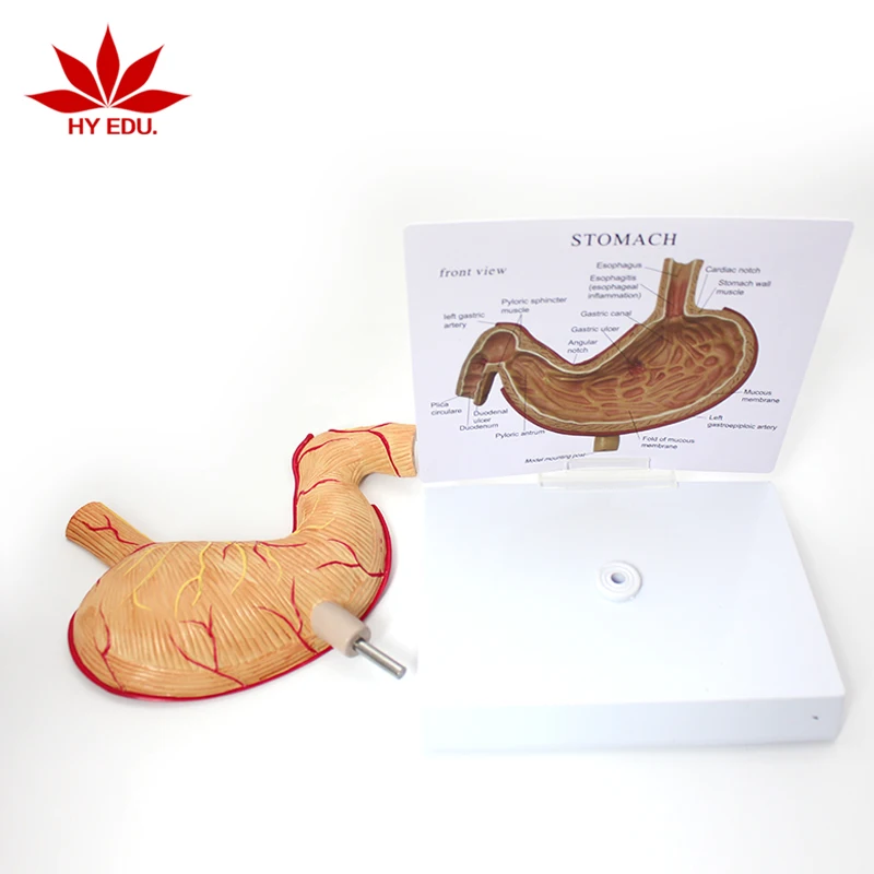 medical teaching  pathological stomach anatomical  model human stomach gastric ulcer