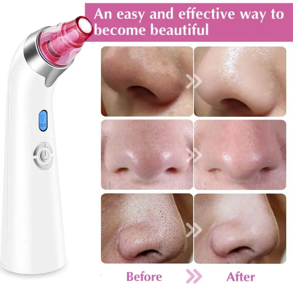 Wholesale Product  Heads Probes OEM/ODM Accept Skin Care Beauty Device Blackhead Removal Comedone Remover