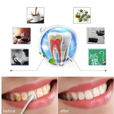 Teeth Whitening Water Oral Hygiene Cleaning Yellow Teeth Tartar Smoke Stains Tea Stains Tooth Stones Mouth Bitter Bad Breath oem