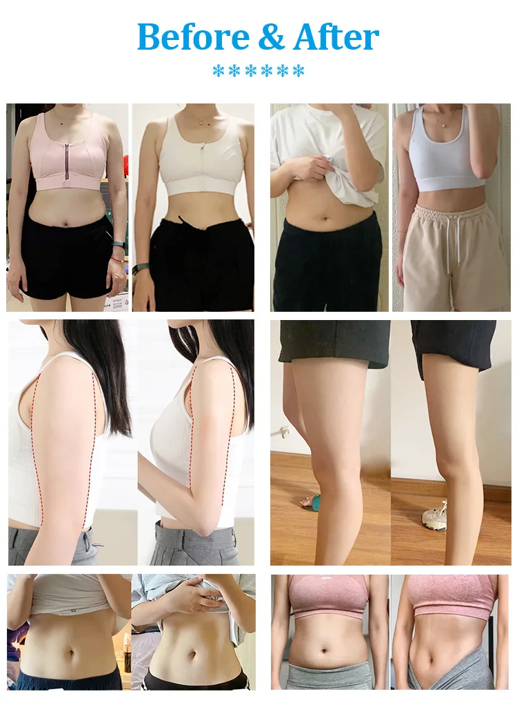 Hot product cold cryo skin cryoslimming cryoems paddles Cellulite Reduction Cryo Pads Slimming Machine for body slimming