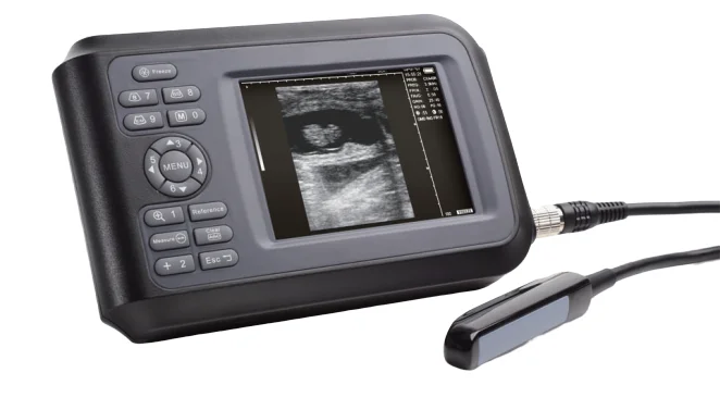 Medical Full Digital Laptop Veterinary Ultrasound Scanner A Sheep Horse Pig Farm Rectal Ultrasound