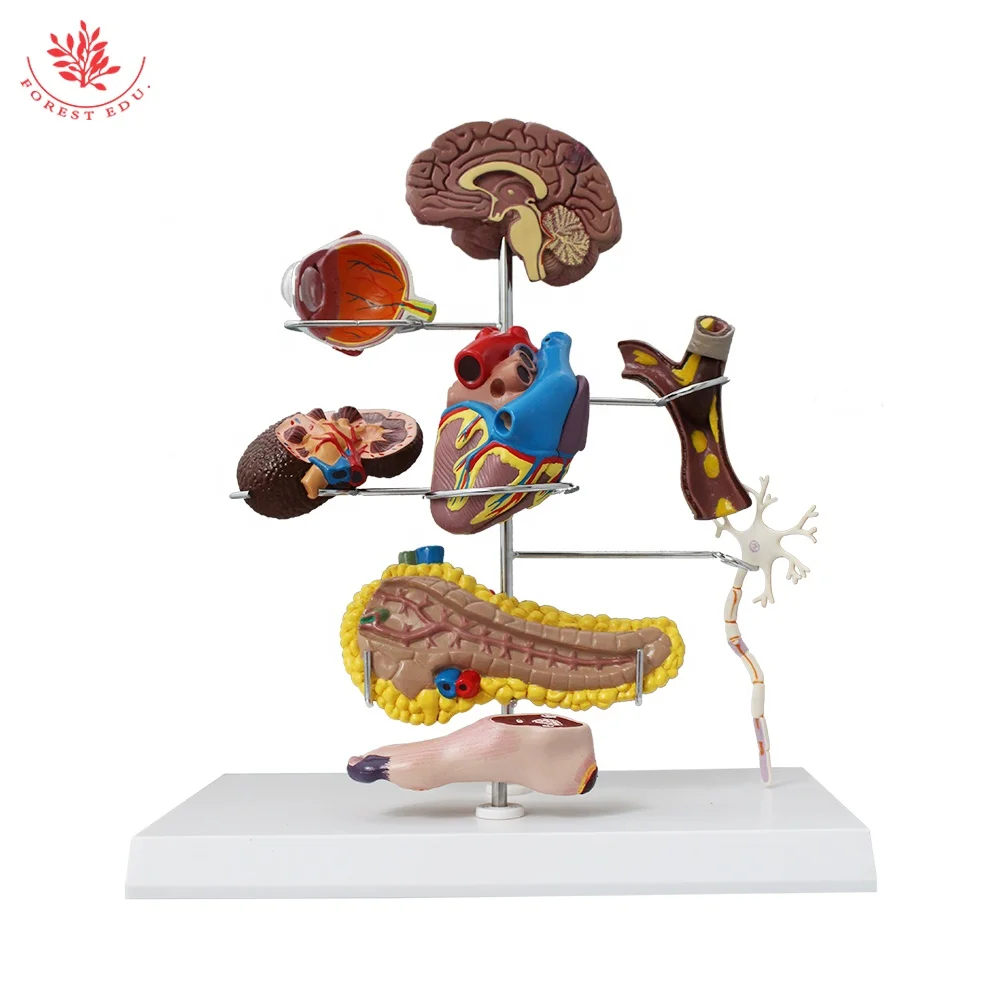 FRESTEDU 8 частей лечение диабета анатомическая модель патологии медицинская медицина анатомические модели