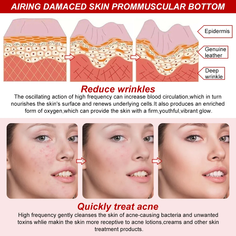 High Frequency Electrode Wand Machine Handheld Skin Tightening Acne Spot Wrinkles Remover Beauty Therapy Puffy Eyes Facial Care