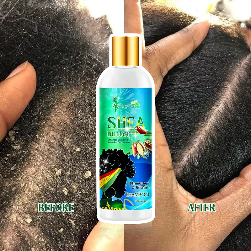 Dreadlocks Hair Care Shampoo And Conditioner Improve Scalp Healthy Shea Butter