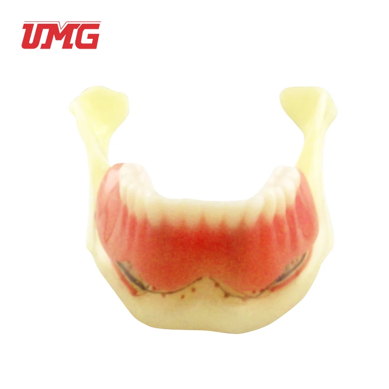 Resin Mandibular Detachable Jaw Bone Denture Model with Belt Nerve and Teeth