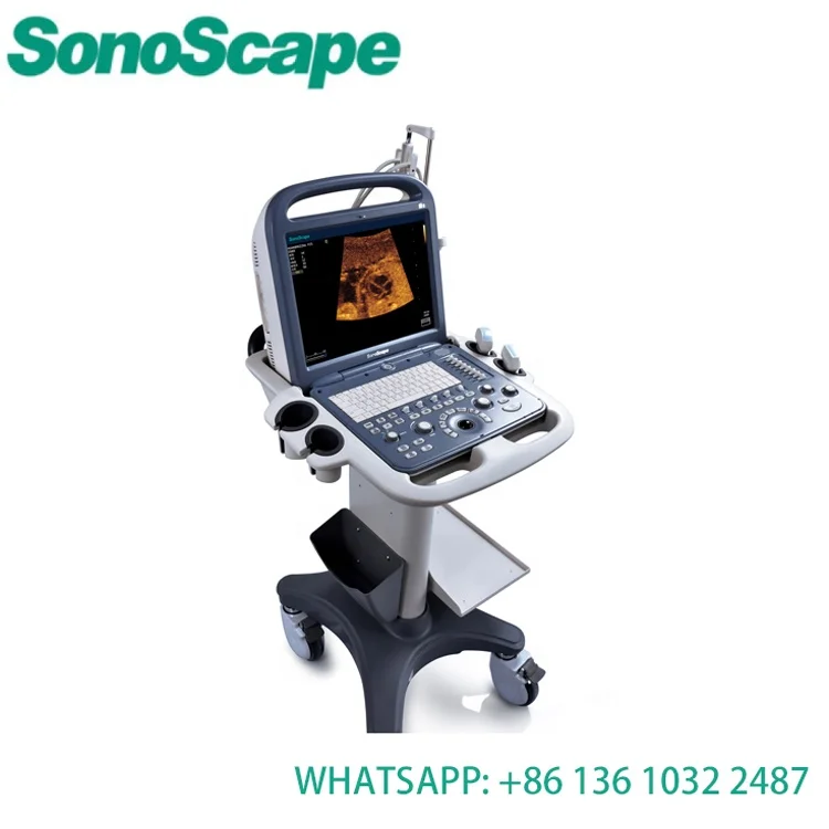  Sonoscape s2 medical ultrasound instruments/color doppler