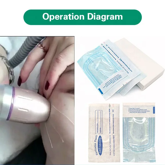 Shyway Needleless Magic Thread Private Label Collagen Lifting Thread White Gold Protein Line