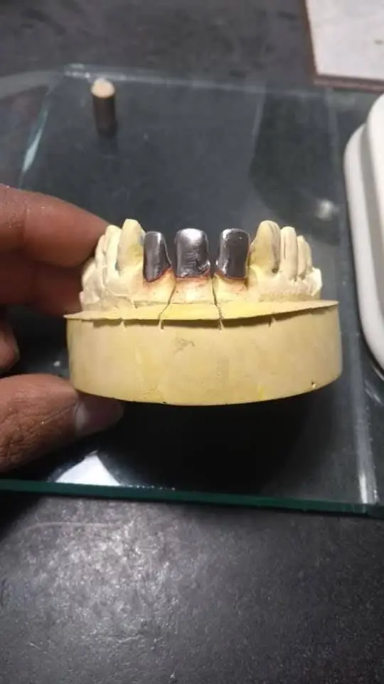 New Material Abrasion Resistance Cobalt Chromium Molybdenum Dental Alloy