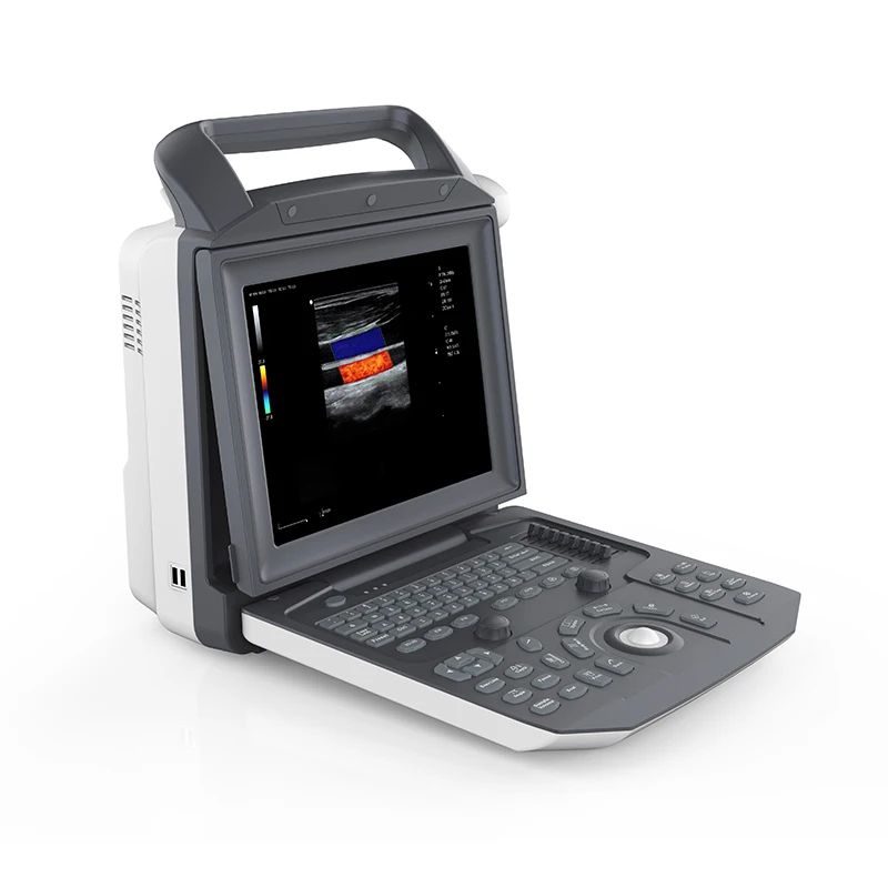 Real Manufacturer Diagnostic Machine Systems Micro Convex Probe Color Doppler 3D 4D Ultrasound Machine