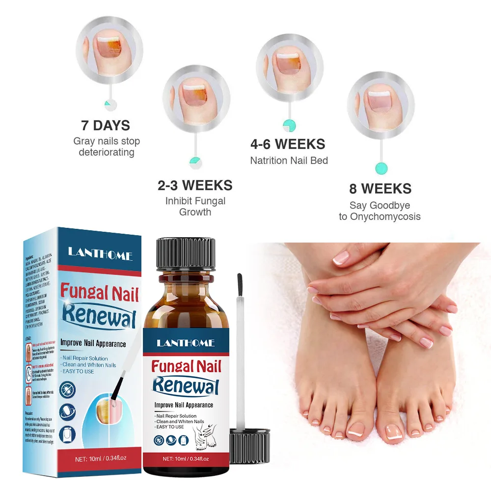 Private Label Best Nail Fungal Treatment Restoring Solution for Toenail & Fingernail