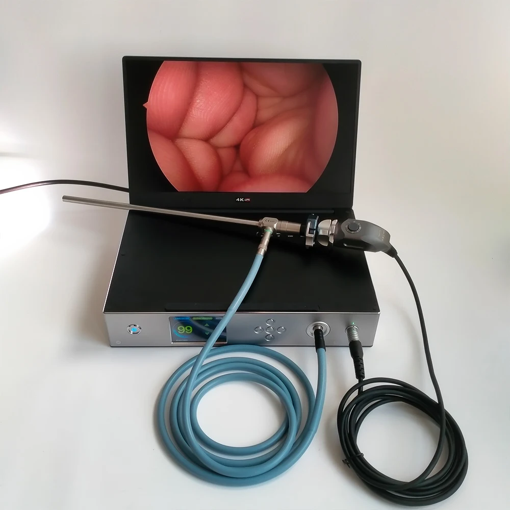 Medical ENT full HD Endoscopy Unit Portable Endoscopic laparoscopic camera