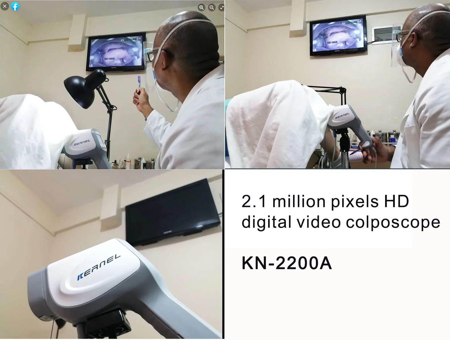Kernel Optical colposcope Digital Video Vagina Colposcope KN-2200A Colposcope for Gynecology