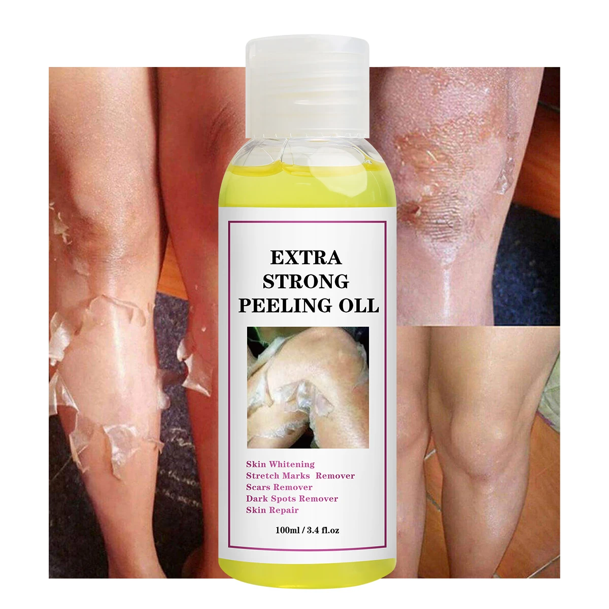 Custom OEM Extra Strong Yellow Peeling Oil Stretch Marks Scar Remove Exfoliating Dark Knuckles Whitening Skin Peel Oil