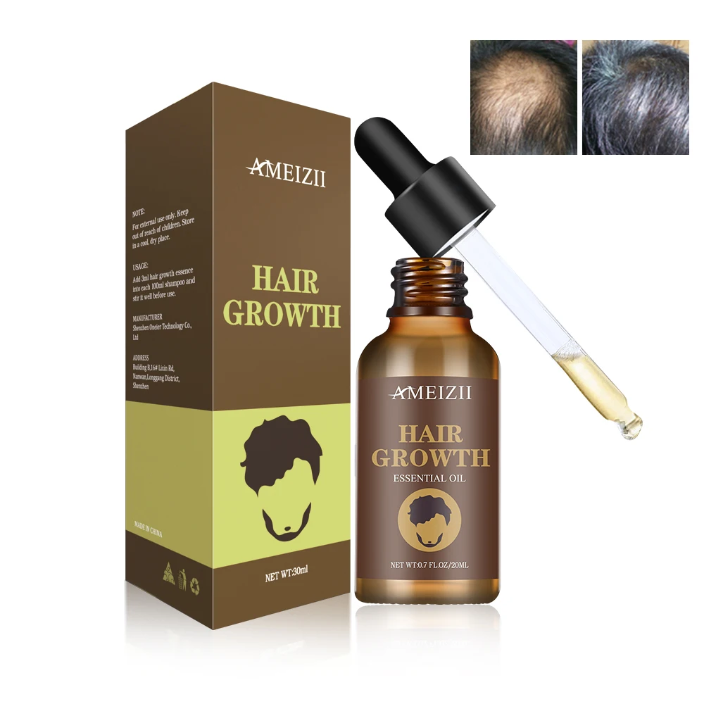 
Private Label Hair Growth Serum Natural Ginger Aceites Esenciales Soin Cheveux Hair Regrowth Hair Loss Treatment Oil For Female  (1600117357060)