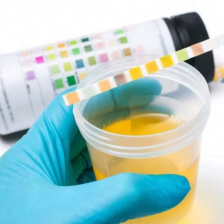 High Quality Supplier Of Urine Strip Analyzer Factory Price Laboratory Reagents