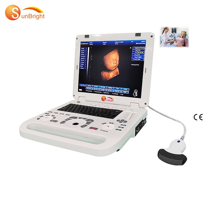 laptop ultrasound vascular diagnostic high end 2D portable usg scanner