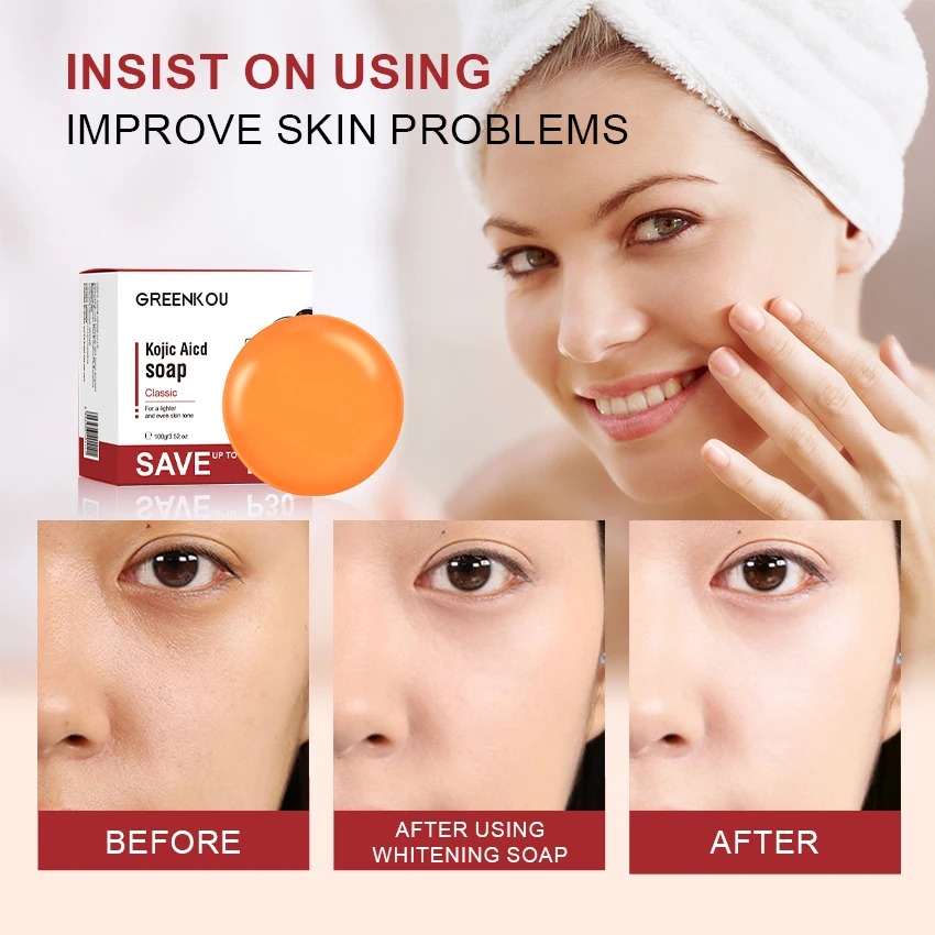 BTJ Kojic acid soap  Brightening and whitening kojic acid soap Fade black spots Acne removal Facial and body soap H1