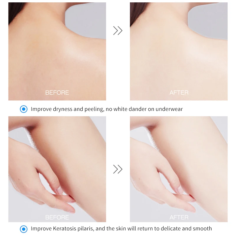 Lady Favorite 4 Types Body Scrub Organic Deep Mild Exfoliating Dead Skin Removal Soothing Silky Brightening Body Care For Unisex