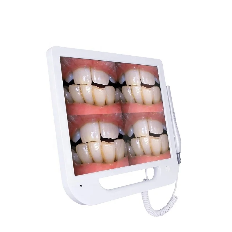 WWG-100 WIFI Dental Intraoral Camera For