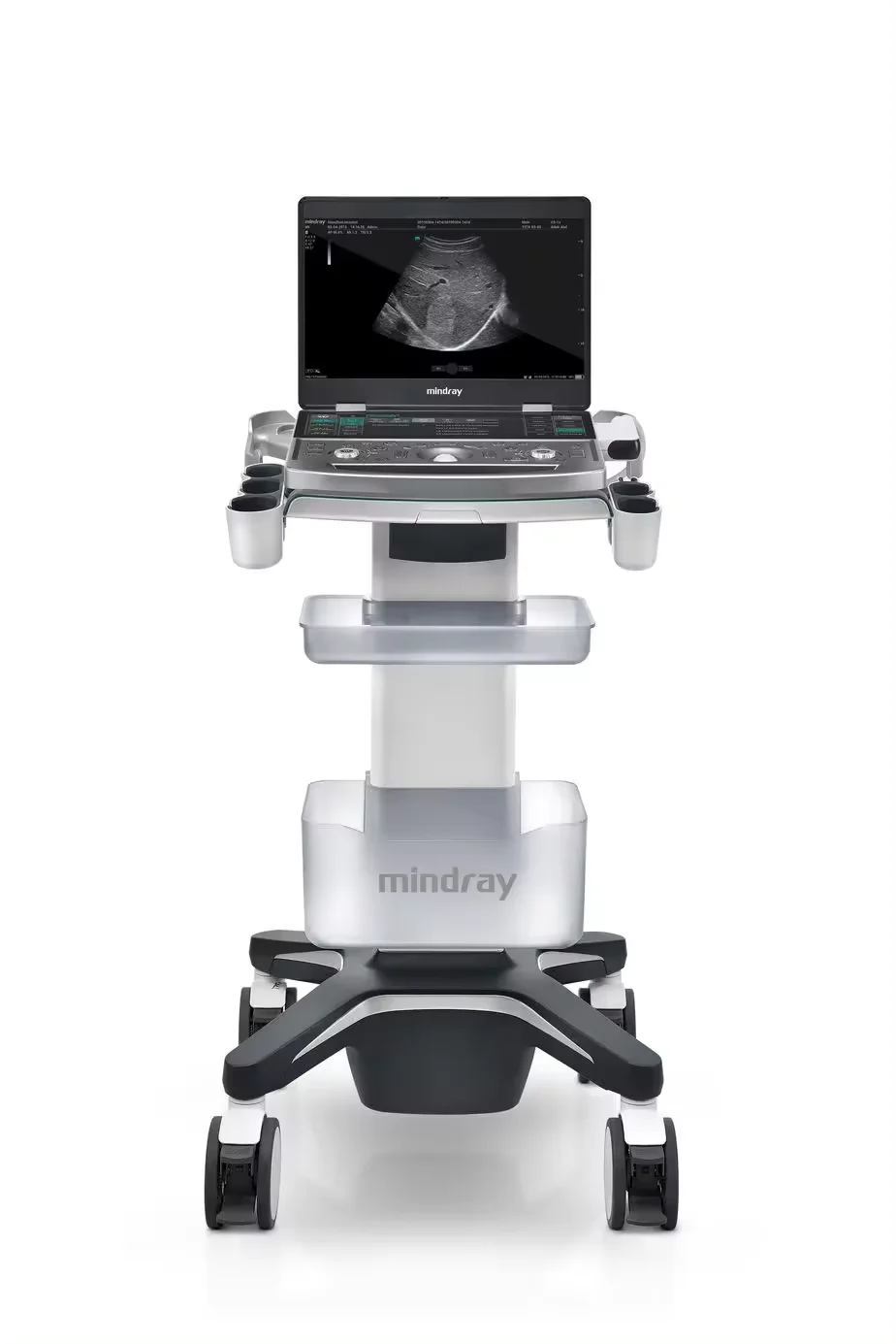 Mindray  MX7 Color Doppler Ultrasound