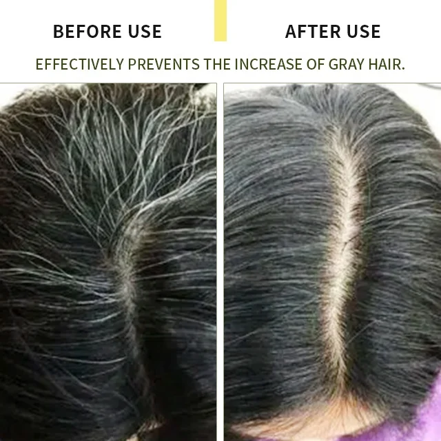 NEW PRODUCT PRIVATE LABEL ORGANIC VEGAN 100ML GINSENG HAIR ESSENCE SERUM FOR GRAY AND  SEVERE MELANIN LOSS HAIR