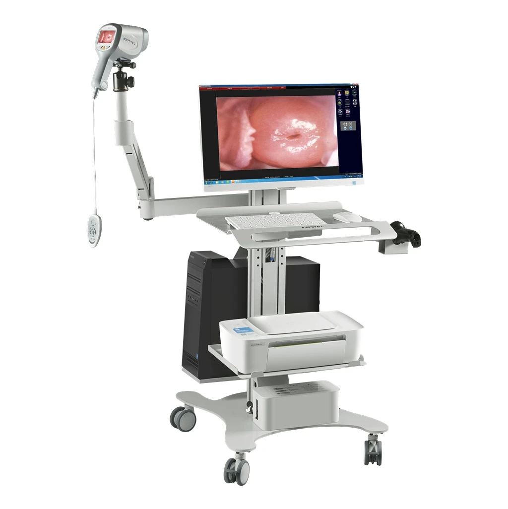  CE утвержден HD colposcope для гинекологии цифровой визуализации системы двойной экран full hd камера влагалища в