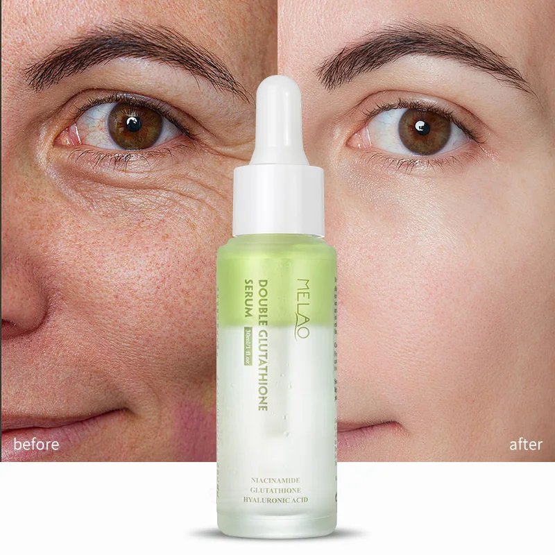 Cosmetic Supplier OEM Skin Whitening Double Glutathione Serum Skin Brightening Balance Skin Tone Glutathione Serum
