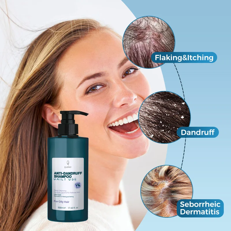 Qquaker Professional Anti Dandruff Shampoo 1% Selenium Sulfide Anti Hair Loss Hair Care Products For Oily Hair
