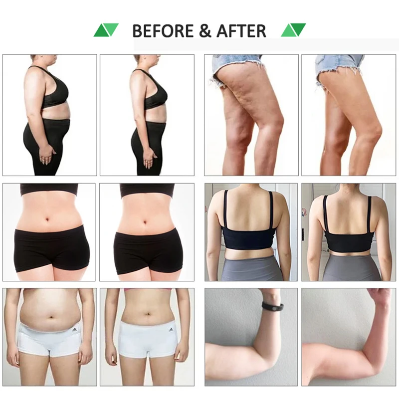 Professional fat removal weight loss max lipo slim system 10d laser machine with ems cryo pads