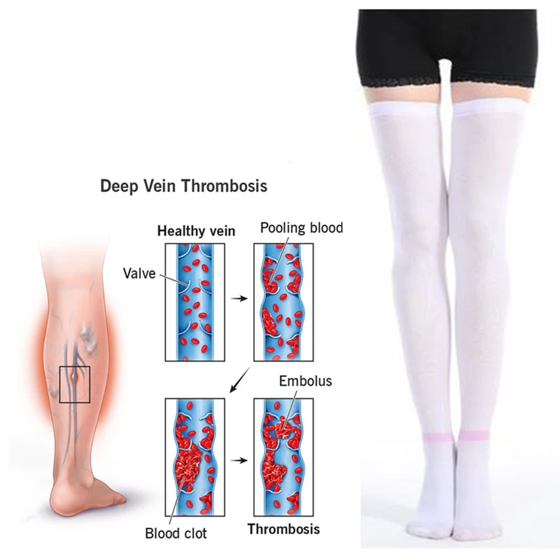 wholesale Medical Anti thrombotic Thigh High Stockings Compression Anti embolism TED Open-toe stocking anti-embolism stockings