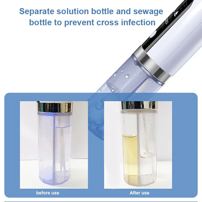 Electric Bubble Facial Cleansing Tool Blackhead Removal Pore vacuum