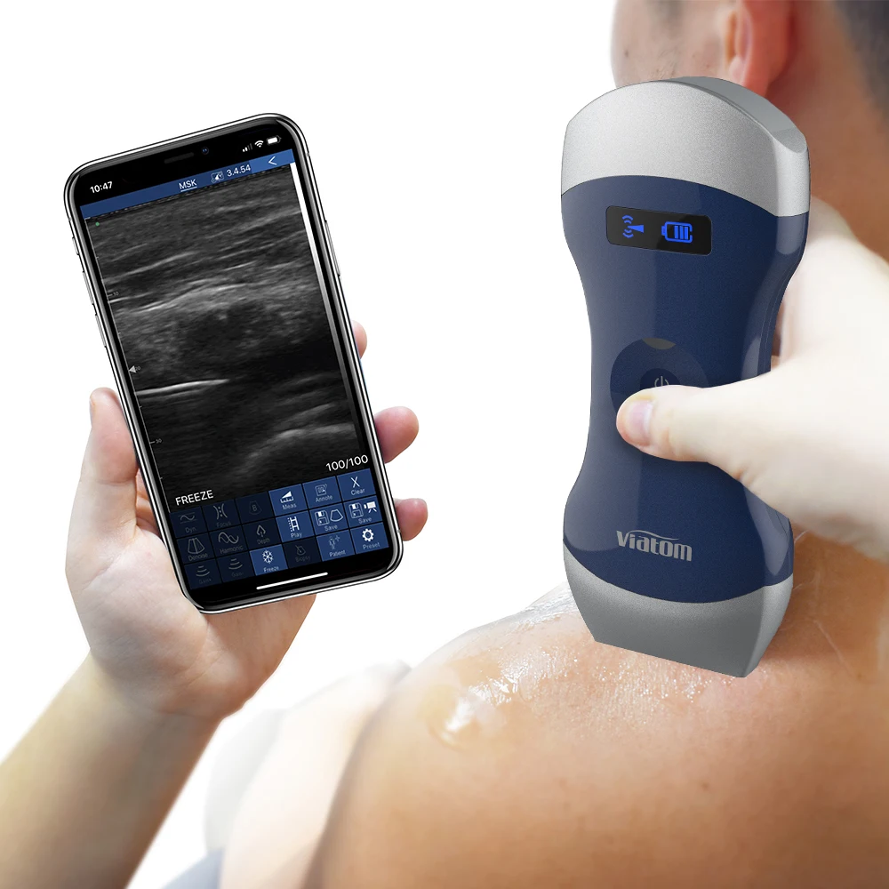 Viatom Wireless Portable Human Ultrasound Machine High Quality Medical Machine Ultrasound Probe