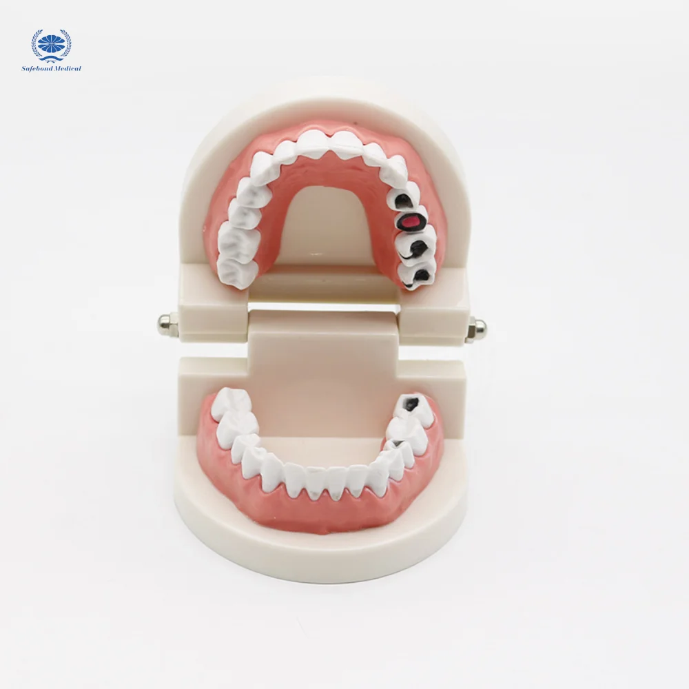 Dental model for medical teaching Dental plastic tooth model
